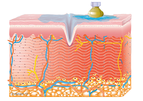 Image of how Collagen Synthesis Begins
