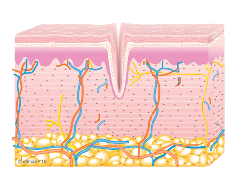 Image of Untreated Skin