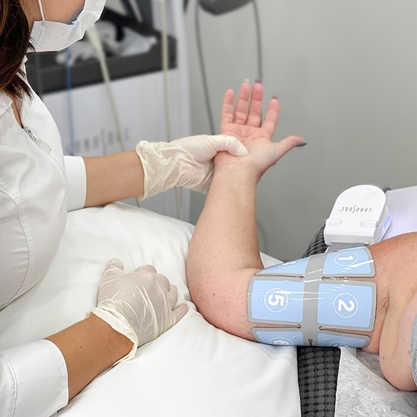 flexsure body contouring on arms