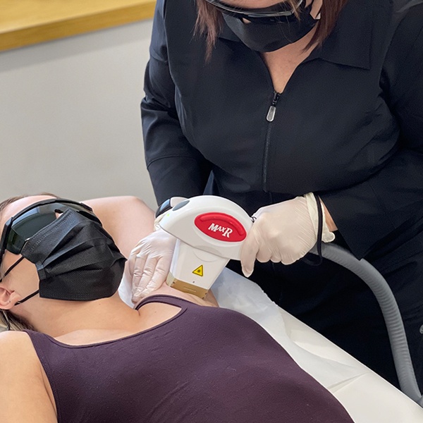underarm laser hair removal treatment