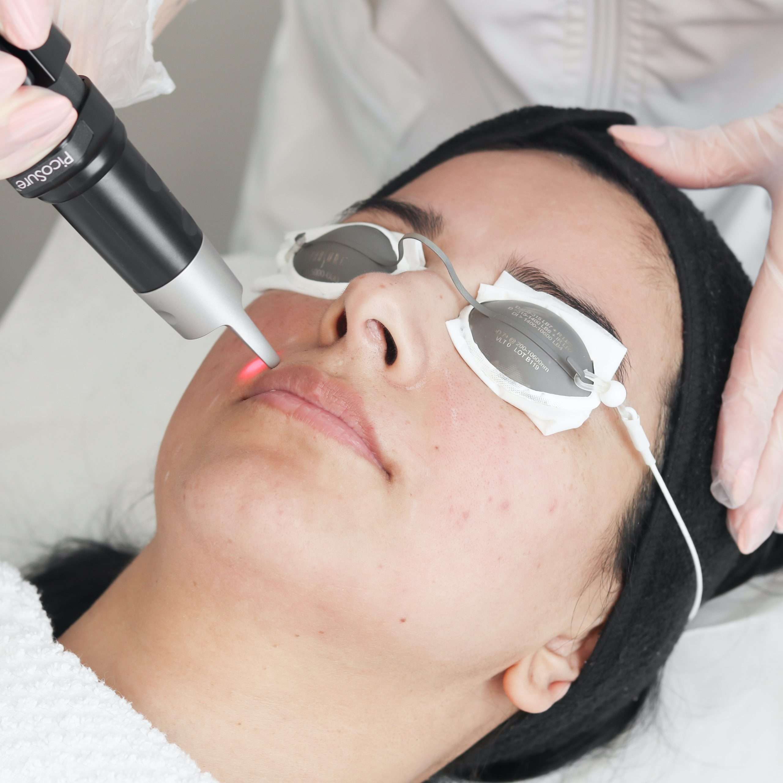 Woman receiving PicoSure skin revitalization treatment.