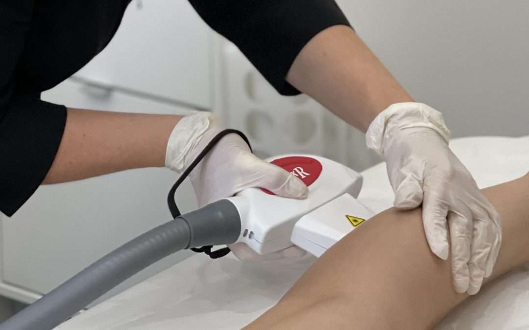Everything you’ve always wondered about Laser Hair Removal in Winnipeg