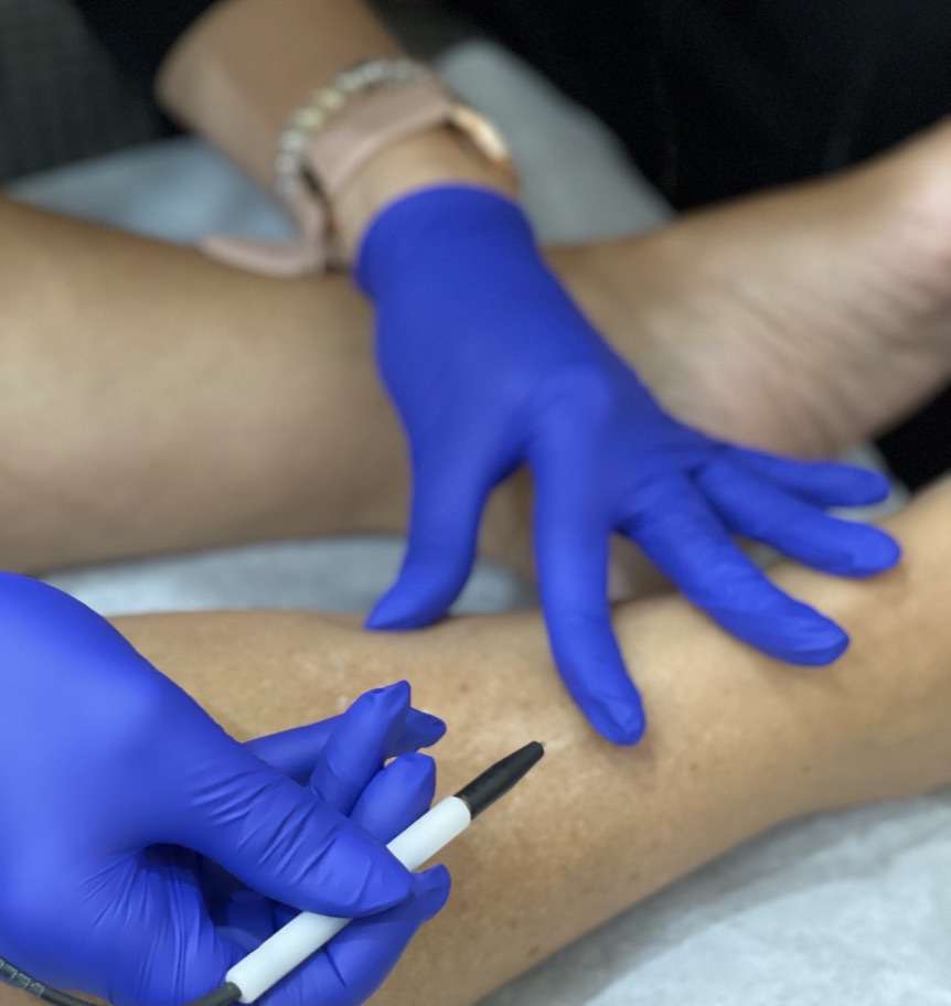 Marking dark spots on client