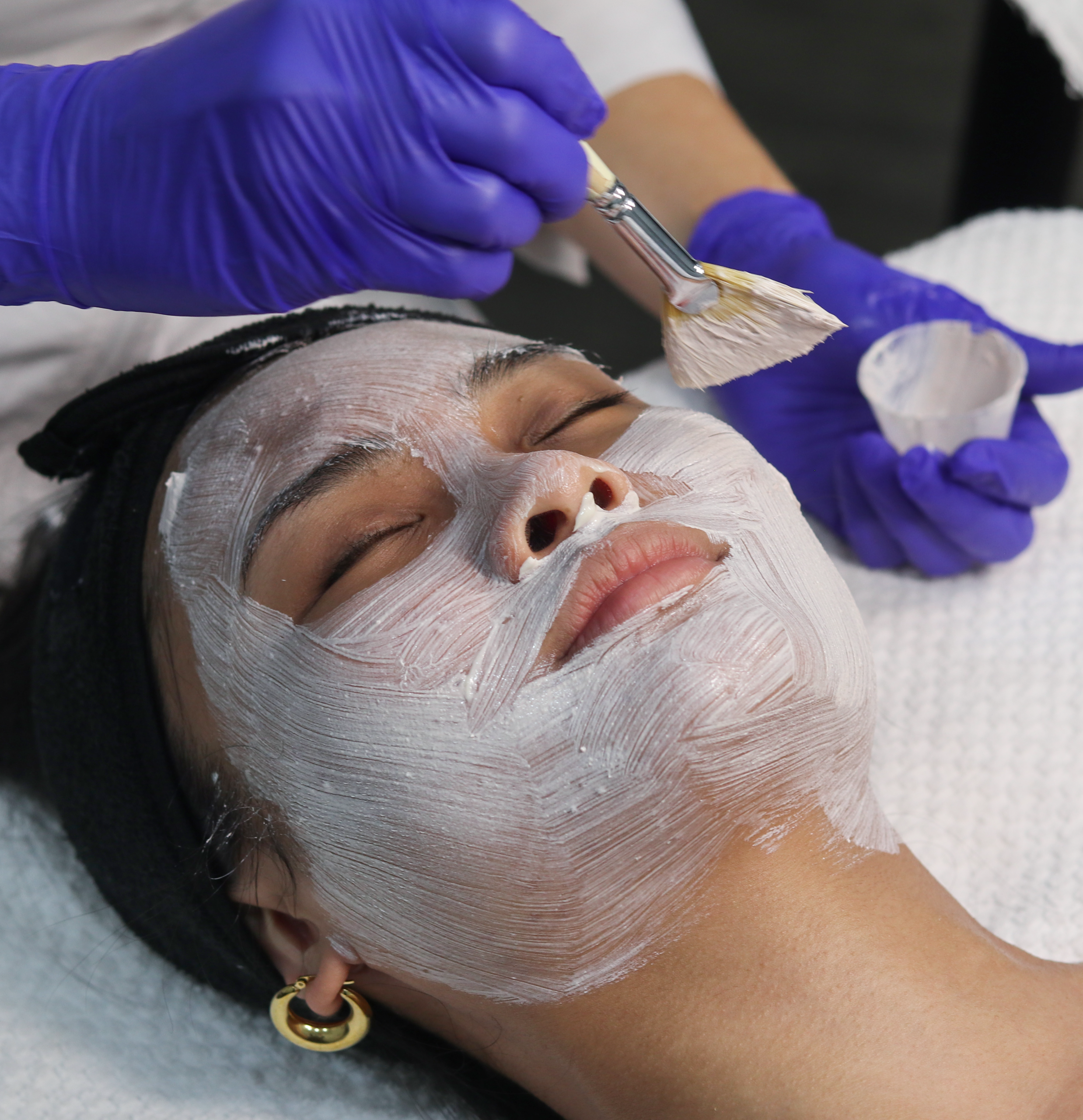Esthetician performing an acne facial treatment