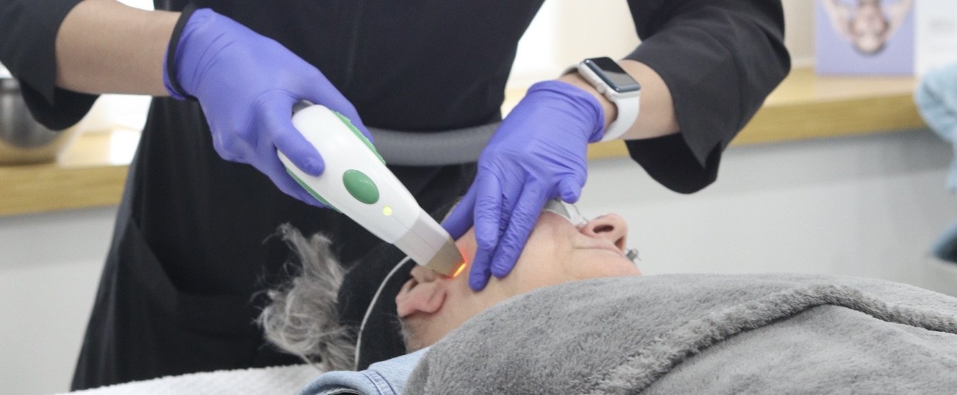 fractional laser resurfacing treatment on client