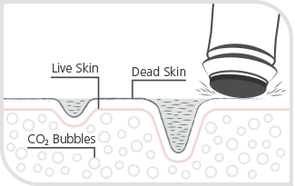 OxyGeneo Exfoliate treatment diagram how it works