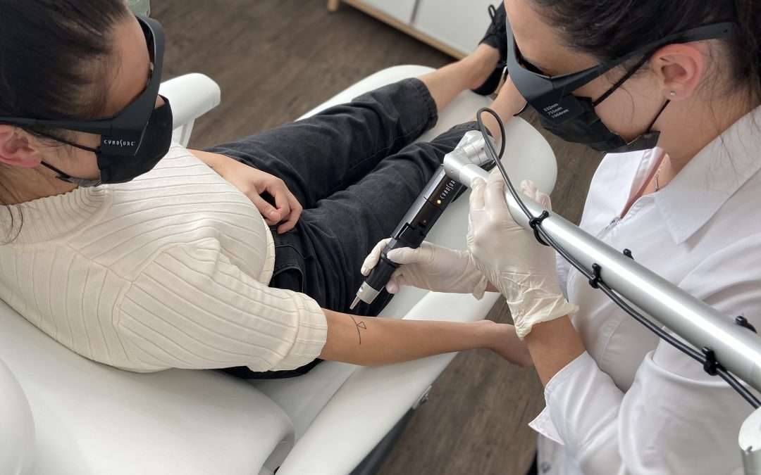 laser tattoo removal on client's arm.