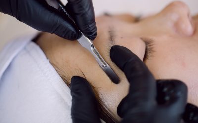 Why Dermaplaning in Winnipeg is on the Rise