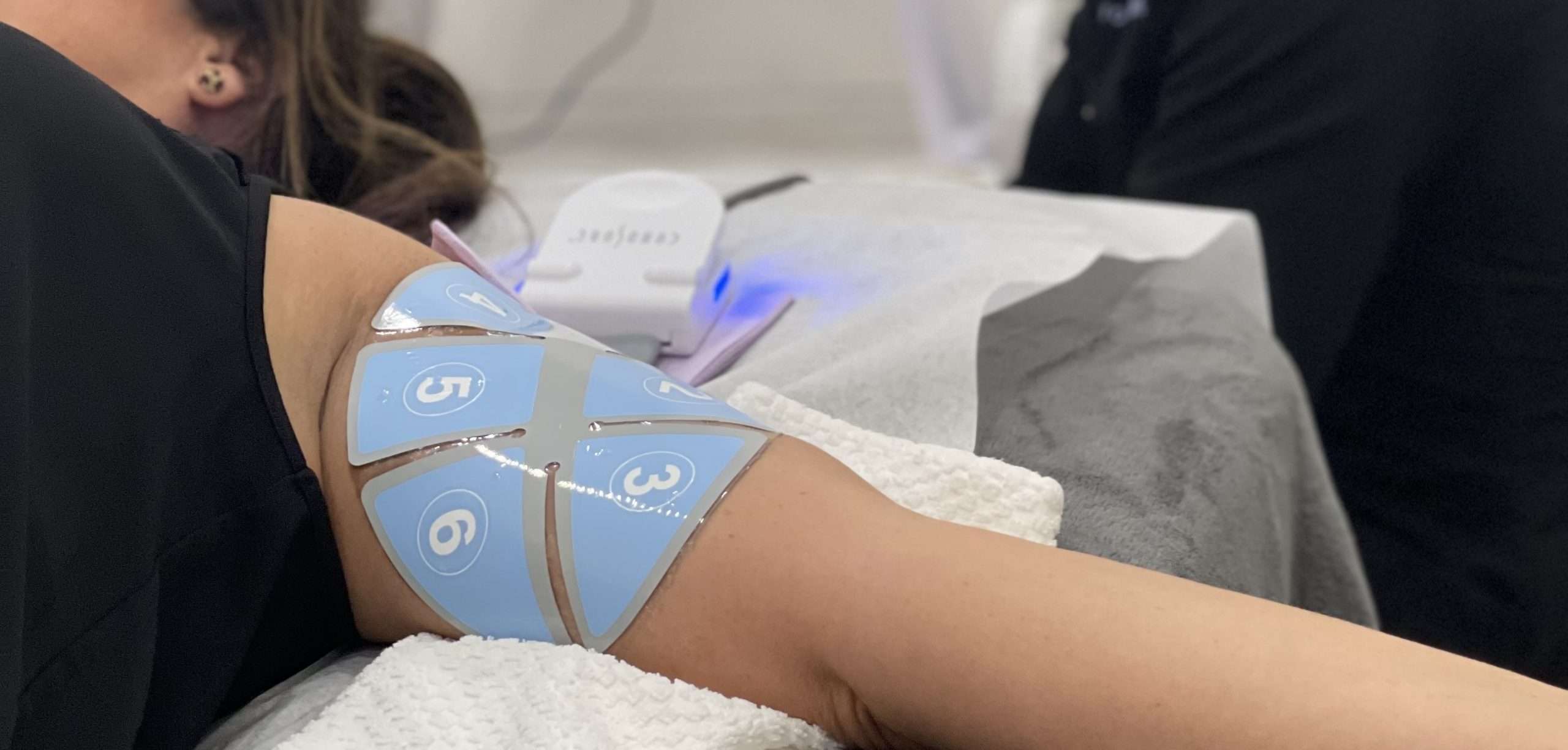 woman getting a flexsure treatment