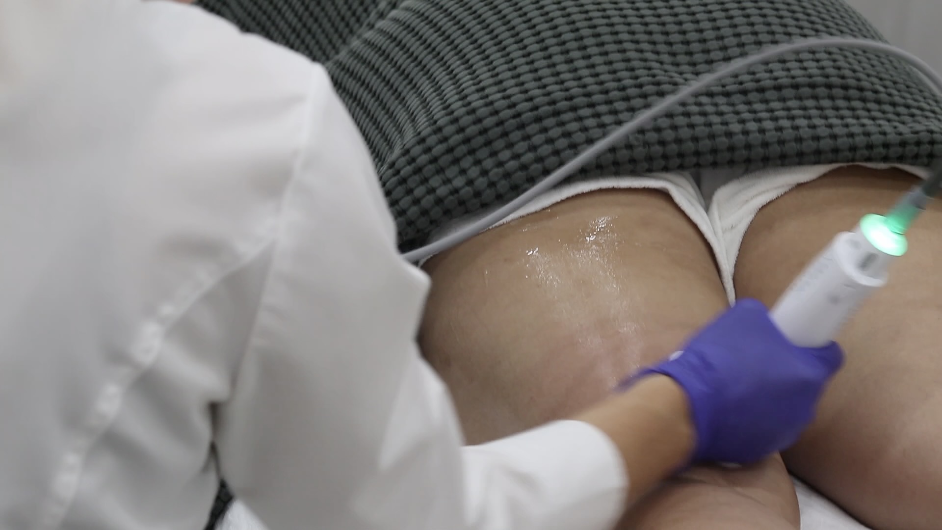 cellulite treatment in winnipeg using tempsure machine on the legs.