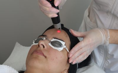 Laser Skin Resurfacing: Age gracefully on your own terms