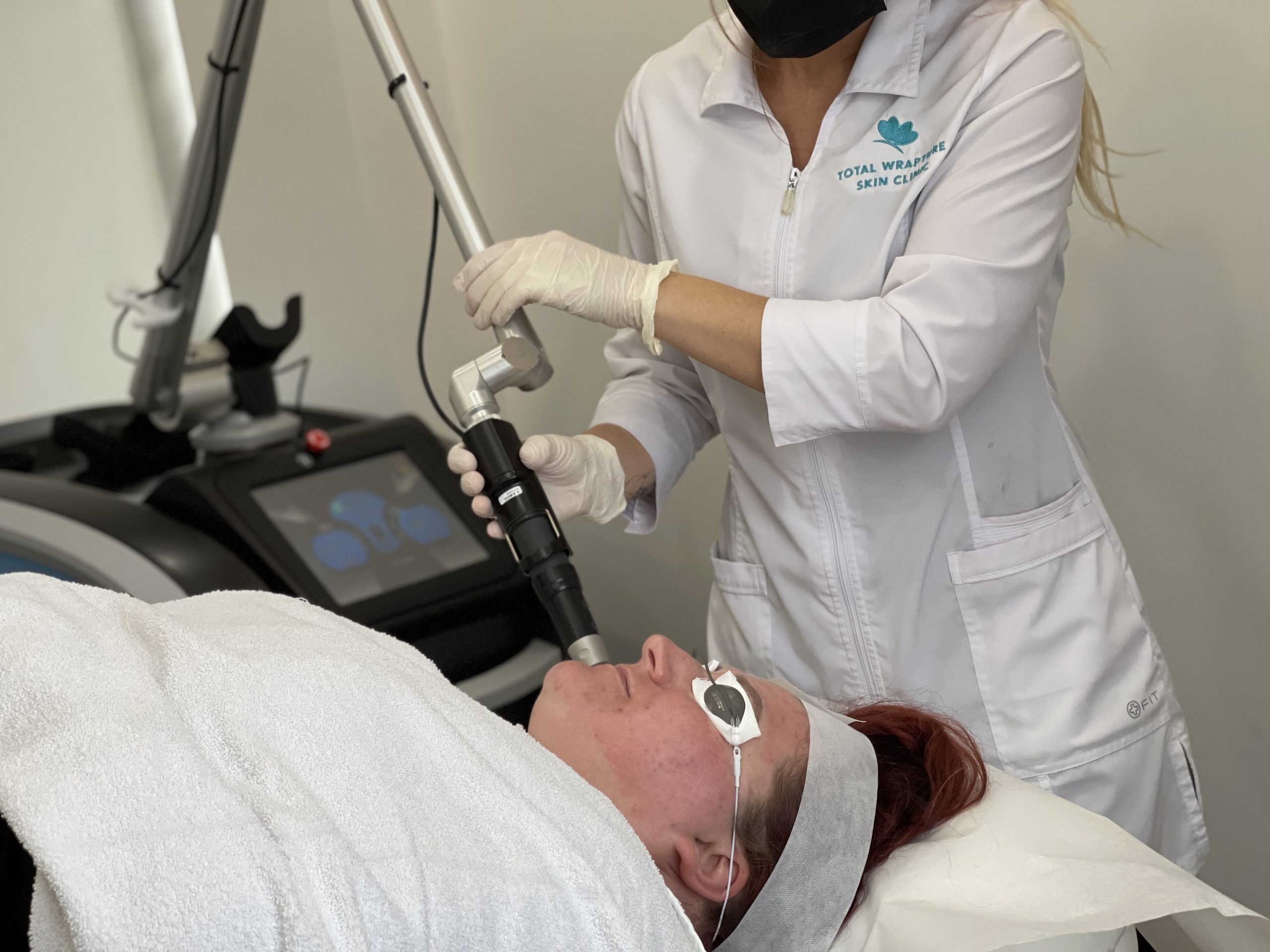 Picosure laser treatment on face, reducing pigmentation