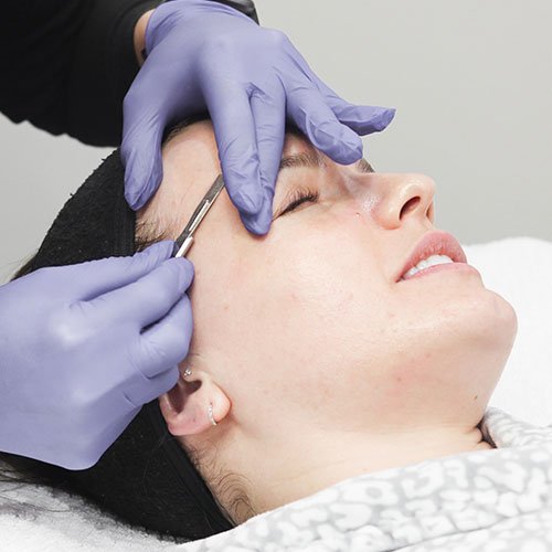 Dermaplaning Exfoliating Treatment at Total Wrapture Medi Spa Winnipeg