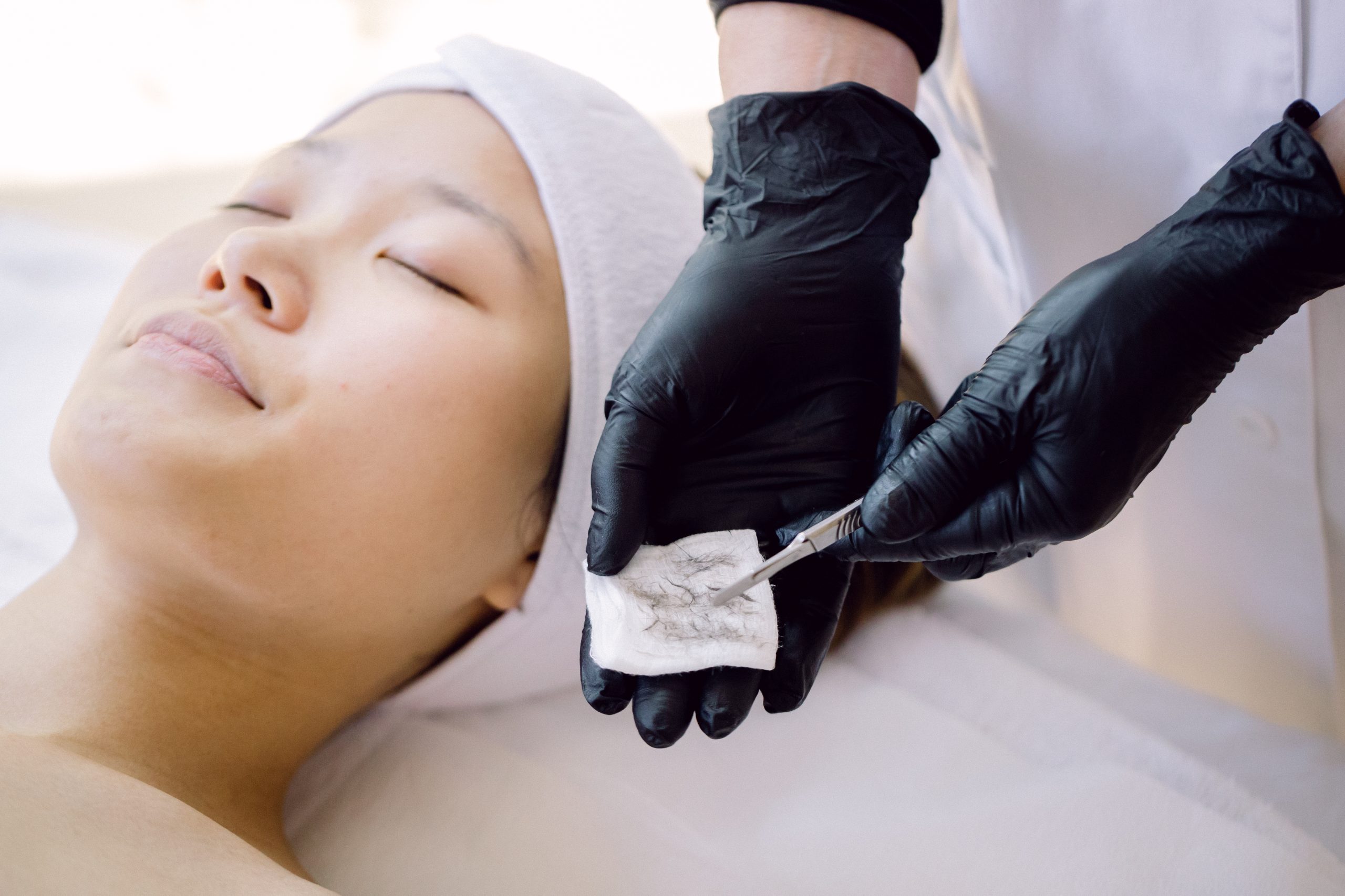 dead skin after dermaplaning facial