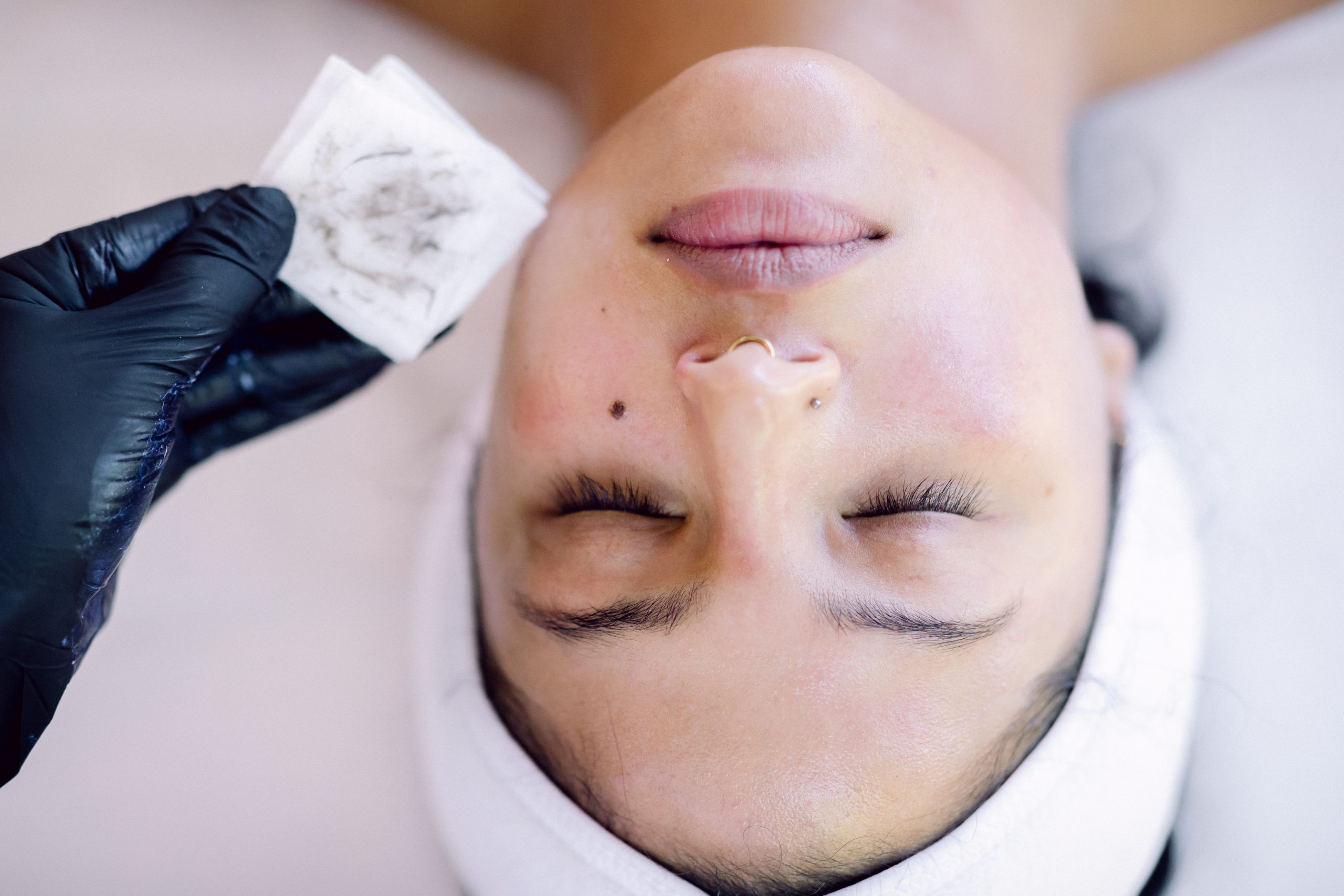 dermaplaning facial dead skin on cotton pad