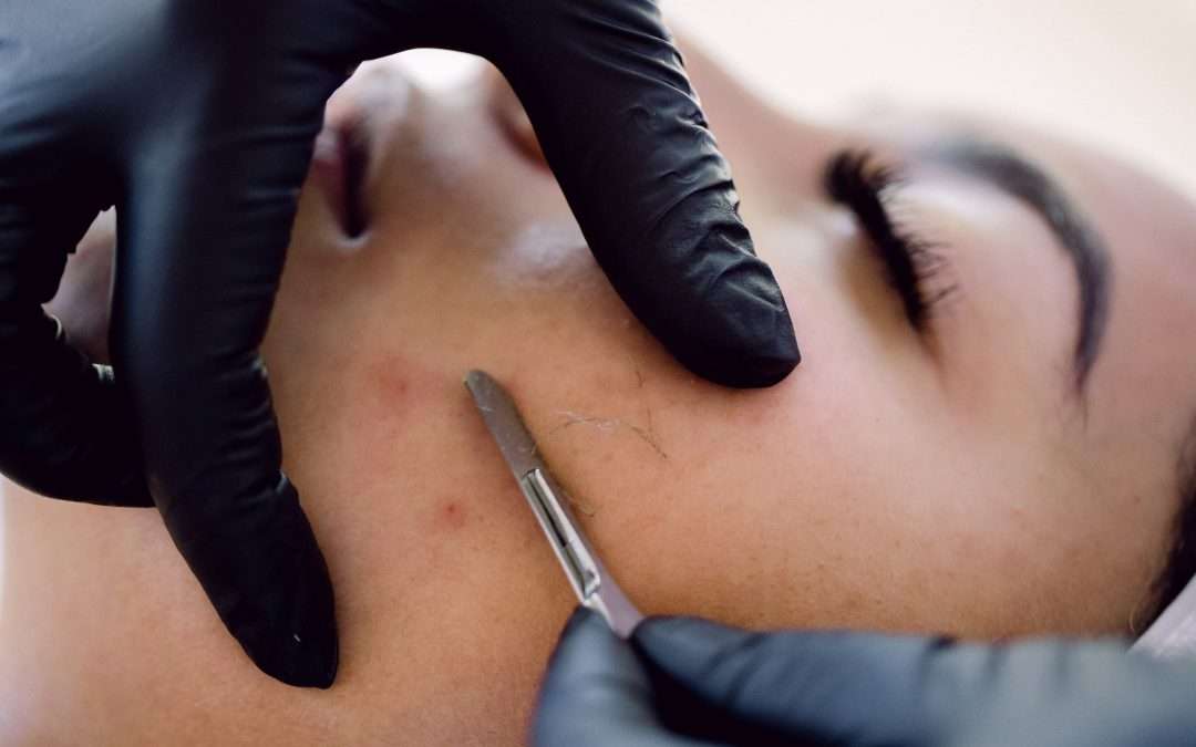 Dermaplaning facial on client's cheek. Facial treatments in Winnipeg