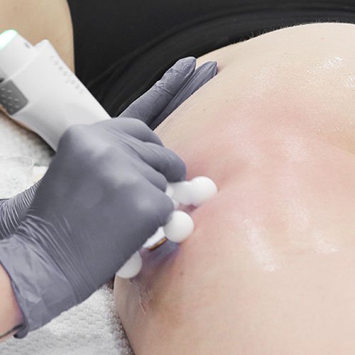 Cellulite solutions at Total Wrapture Medi Spa in Winnipeg, Manitoba