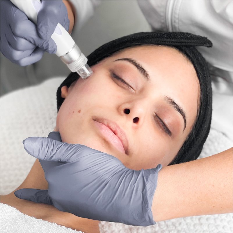 Facial services in Winnipeg Manitoba