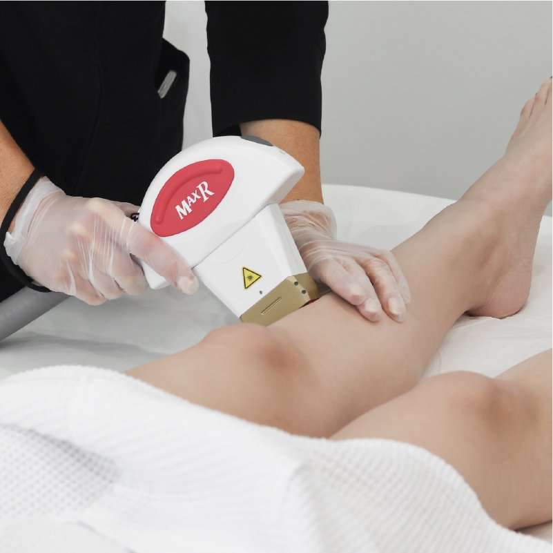 Laser hair removal services in Winnipeg