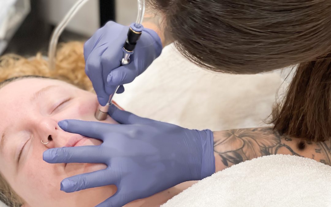 microdermabrasion treatment on a client