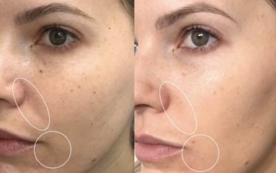 3 Reasons to Fight Gravity with a Re-Volumizing Beauty Booster