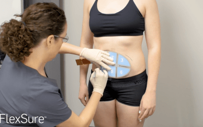 It’s RF Body Contouring Season in Winnipeg