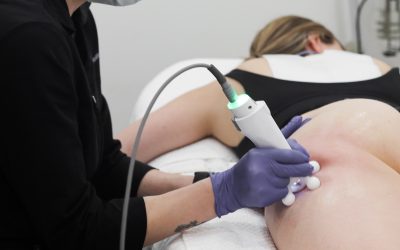 Treating Cellulite in Winnipeg: 6 Reasons Why RF Should Be on Your Radar