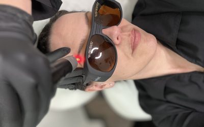 Microblading Removal: 10 Things You Should Know