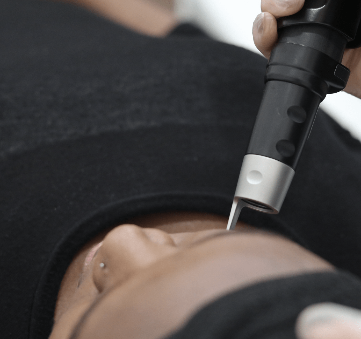 "a person getting microblading removal using picosure laser"