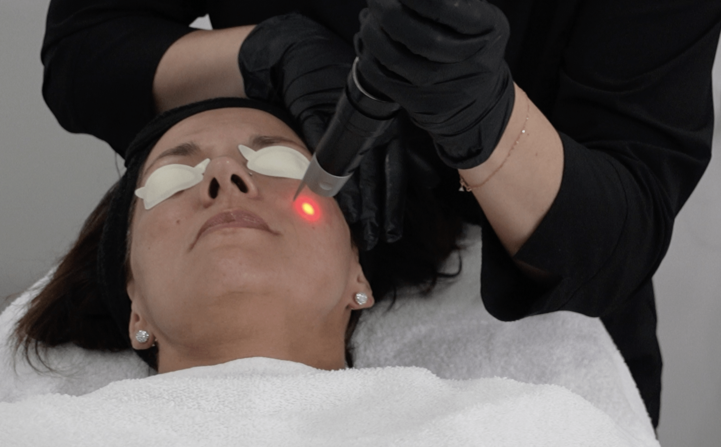 laser treatments to help the skin rejuvenate itself and look younger