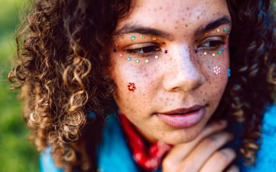A Girl’s Guide to Hyperpigmentation Skin Care and Acne Scars