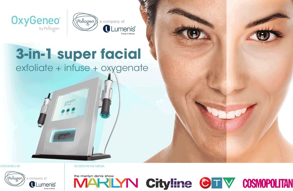 An ad for Oxygeneo showing the machine and a half-treated face