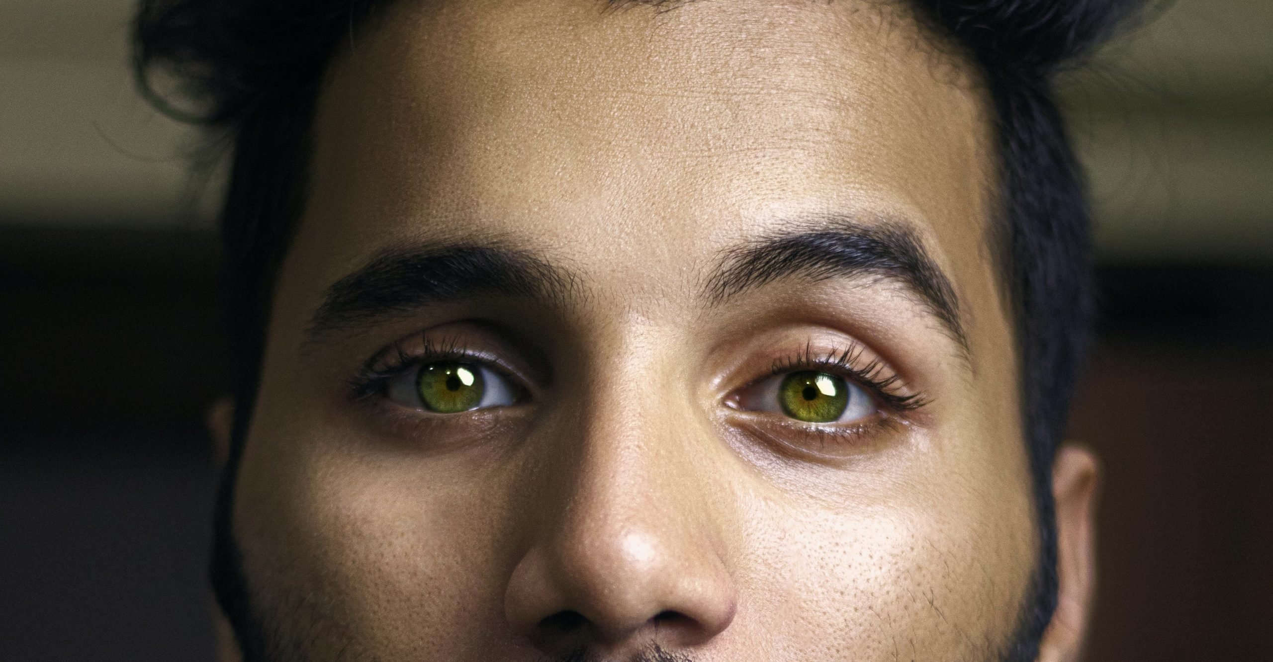 a close up of a man's face after a chemical peel in winnipeg