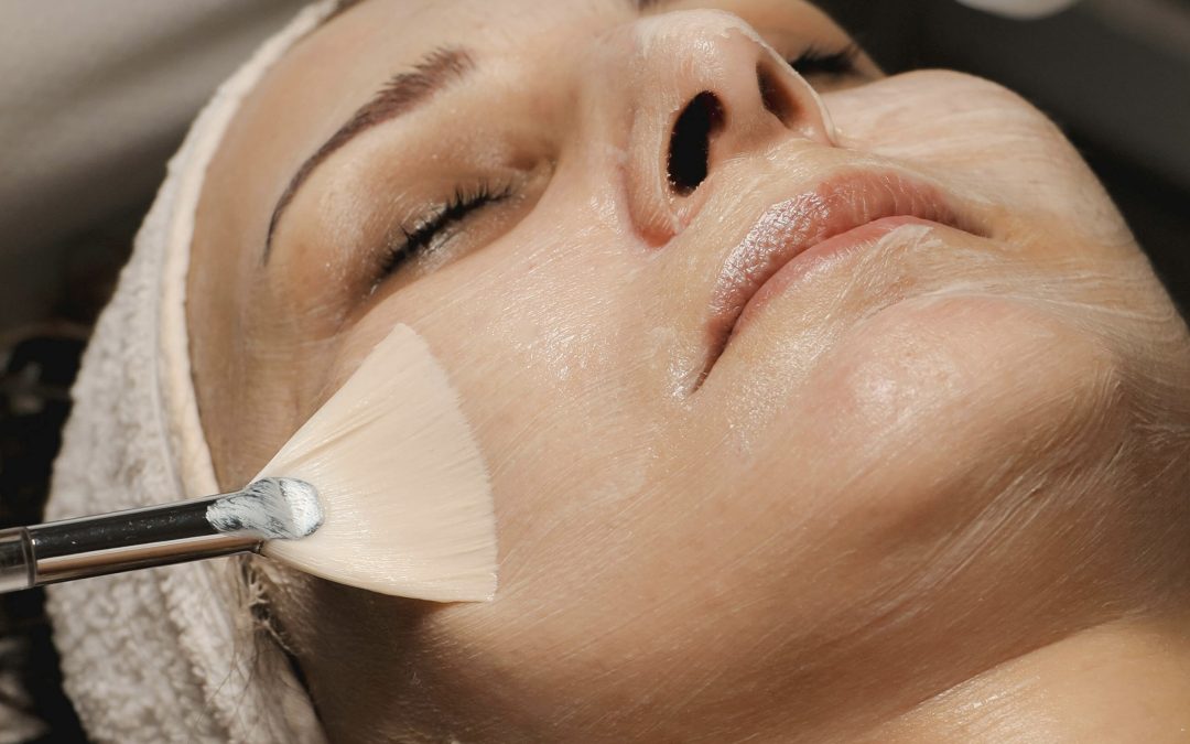A chemical peel being applied in Winnipeg